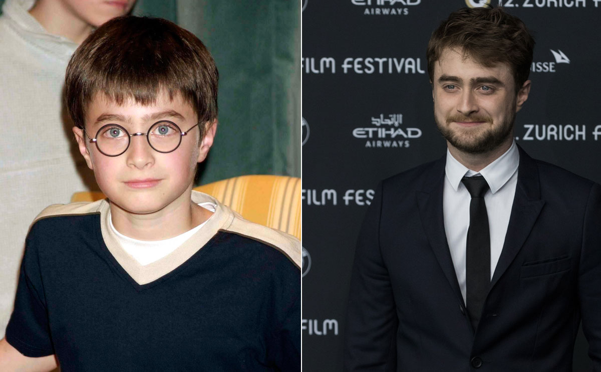 Hur Ser Harry Potter Ut Nu