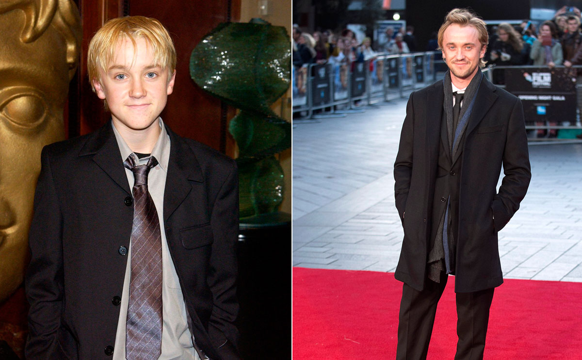 Hur Ser Harry Potter Ut Nu